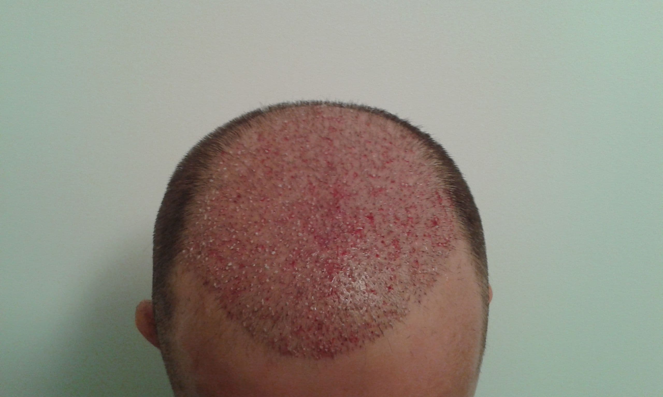 Additional image 2 - Patient 4