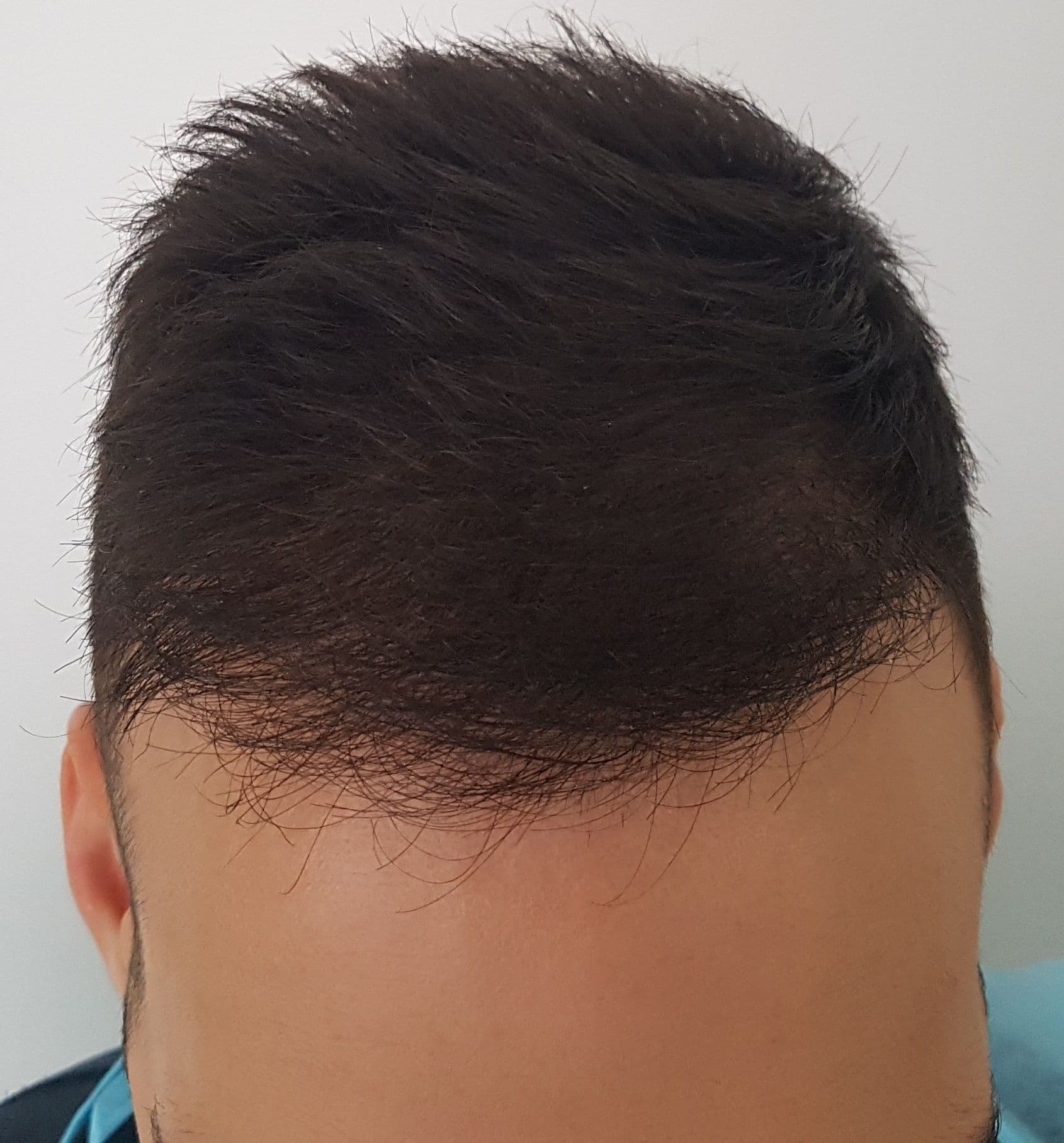 After treatment - Patient 2