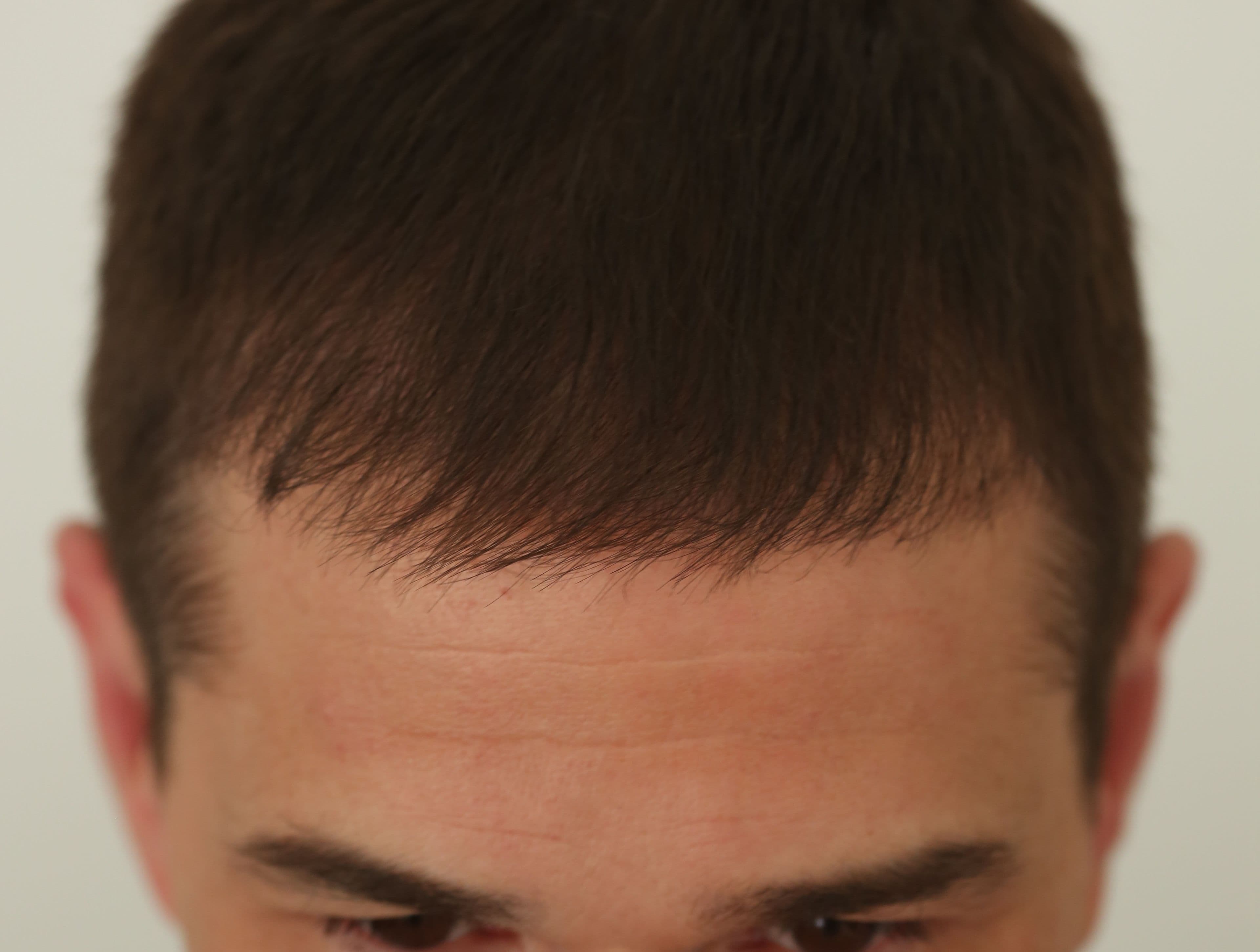 Additional image 2 - Patient 1