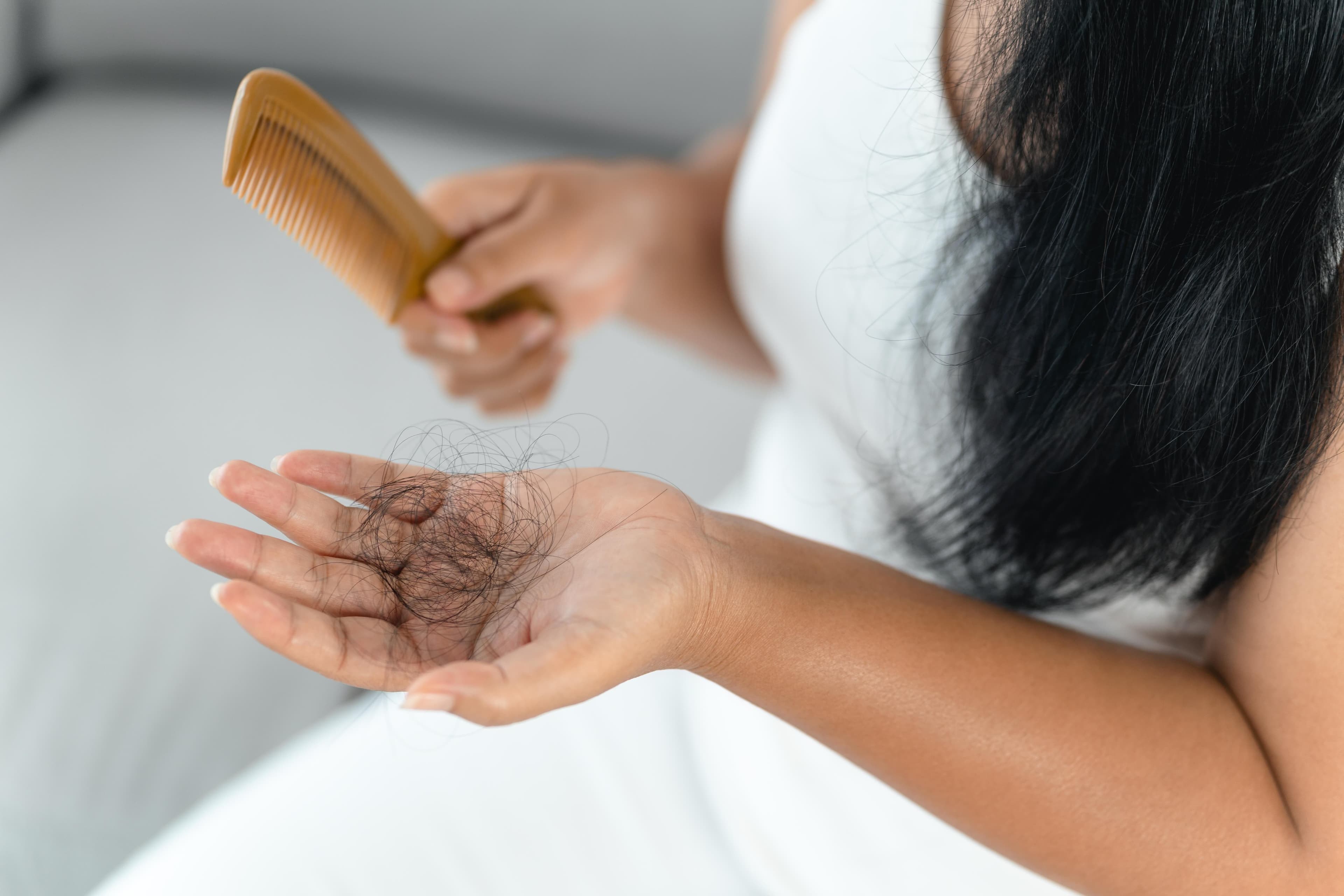 Hair Loss in Women