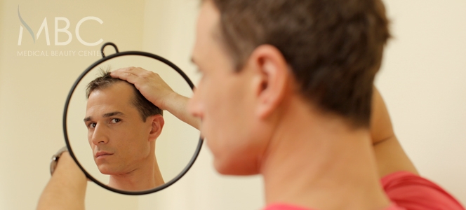 Hair Loss in Men